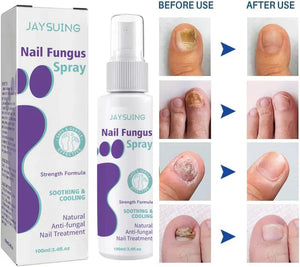 ðŸ¦¶ Medinail Advanced Antifungal Foot & Nail Spray â€“ Soothing & Cooling Treatment for Athleteâ€™s Foot, Nail Fungus, and Odor Control â€“ 100ml