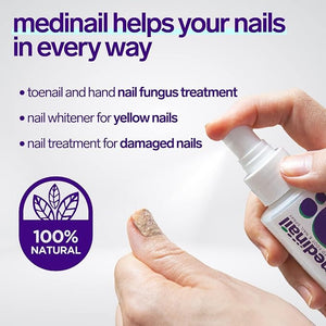 ðŸ¦¶ Medinail Advanced Antifungal Foot & Nail Spray â€“ Soothing & Cooling Treatment for Athleteâ€™s Foot, Nail Fungus, and Odor Control â€“ 100ml