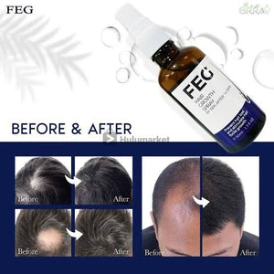 ðŸŒŸ FEG Hair Growth Spray â€“ Boost Hair Growth by 38% in Just 14 Days! ðŸŒŸ