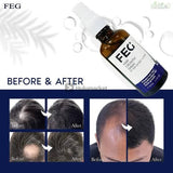 ðŸŒŸ FEG Hair Growth Spray â€“ Boost Hair Growth by 38% in Just 14 Days! ðŸŒŸ